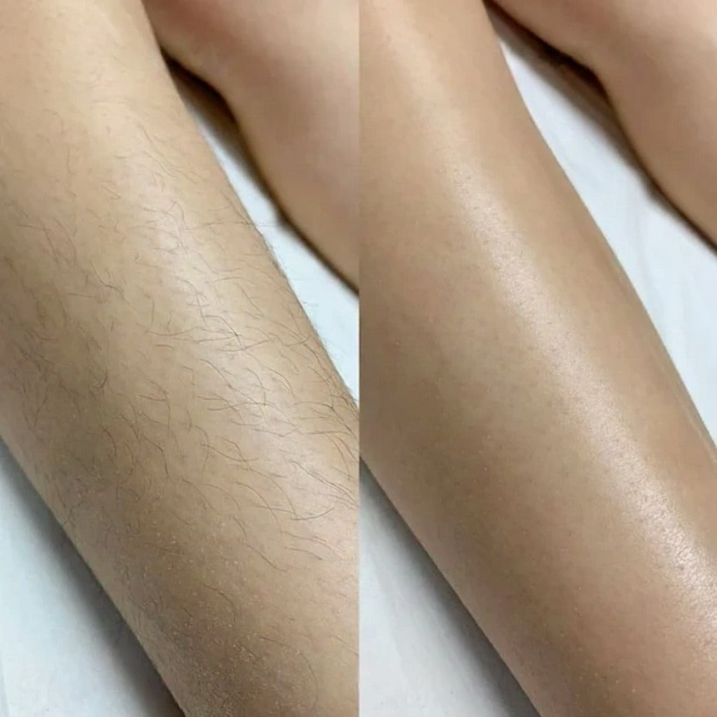 Lissea Black - Depiladora de Cristal